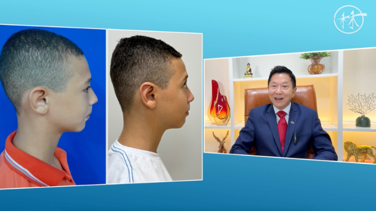 Milton Seigi Hayashi apresenta a lipoescultura facial como técnica eficaz para redefinir o contorno e rejuvenescimento do rosto.